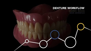 Immediate Denture and Overdenture Workflow
