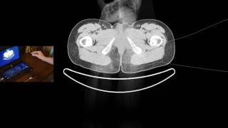 Leapmotion for Medical Data Visualisation
