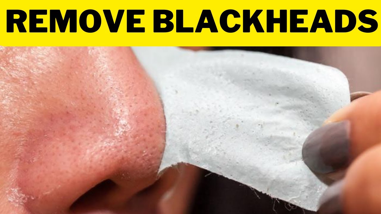 Как выглядит выдавленная черная точка blackheads kaise hataye blackheads kaise nikale blackheads kaise remove karen - 