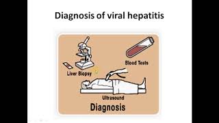 Viral hepatitis and liver cirrhosis الفيروسات الكبديه والتليف الكبدي