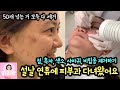 큰맘먹고 피부과에 다녀왔어요 (50개가 넘는 점, 흑자, 색소, 사마귀, 비립종 모두 제거) 엑셀V CO2 레이저 시술 전 과정 꼼꼼히 보여드려요 | 마이맘 TV