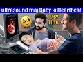 Baby ki heartbeat ka 1st ultrasound revealing my 2nd pregnancy to my father inlaw  he cried in joy