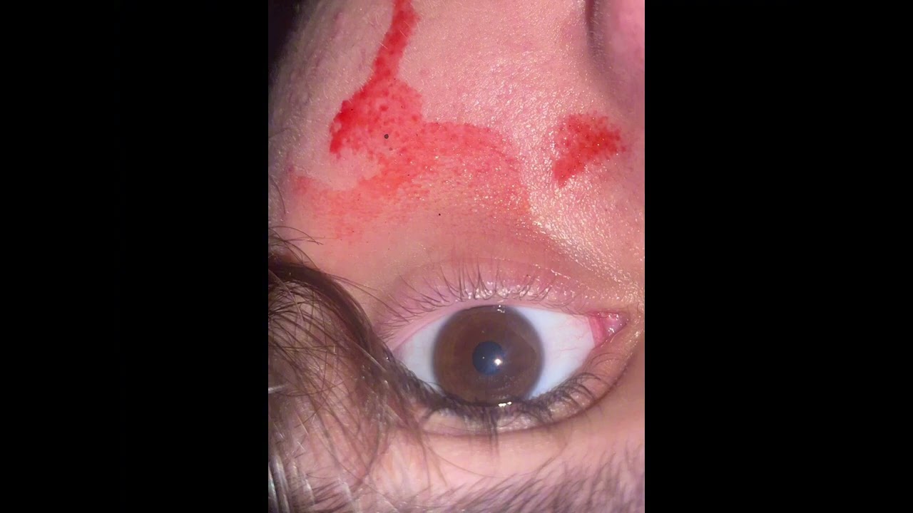 n1ck - Eco no meu peito