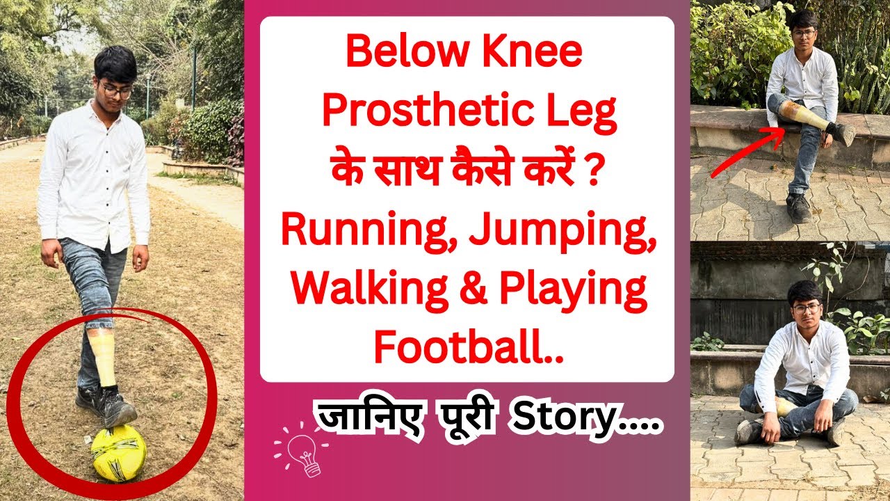 Below Knee Prosthetic Leg | Artificial Below Knee 