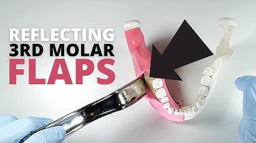 How To Reflect And Retract A Full-Thickness Flap For Third Molar Surgery | OnlineExodontia.com