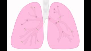 Prevención de las enfermedades respiratorias ocupacionales.