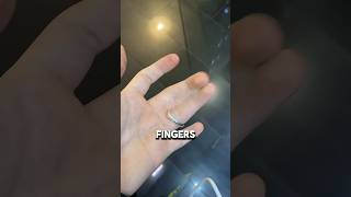 His Fused Fingers Blocked the Ring, Until SHE Found the Perfect Fix! 💍😲