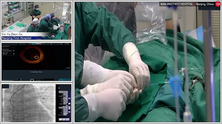 OCT-Guided PCI of Mid-LAD in a Young Patient
