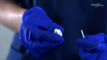 UK- Quantitative Fetal Fibronectin Test: Collection and Analysis