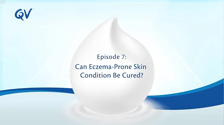 QV #AskDoctorSeries EP7 - Can Eczema-Prone Skin Condition Be Cured?