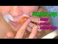 ШУГАРИНГ ЛИЦА В ДОМАШНИХ УСЛОВИЯХ | DIY FACIAL HAIR REMOVAL AT HOME | ЭПИЛЯЦИЯ ВОЛОС НА ЛИЦЕ, УСИКОВ