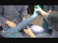 Plantar fasciitis minimally invasive surgery - YouTube