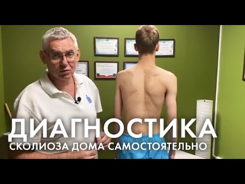 Тест на сколиоз в домашних условиях. 3 метода диагностики сколиоза.