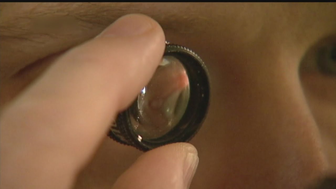 Vision loss, high cholesterol now Alzheimer's symptoms