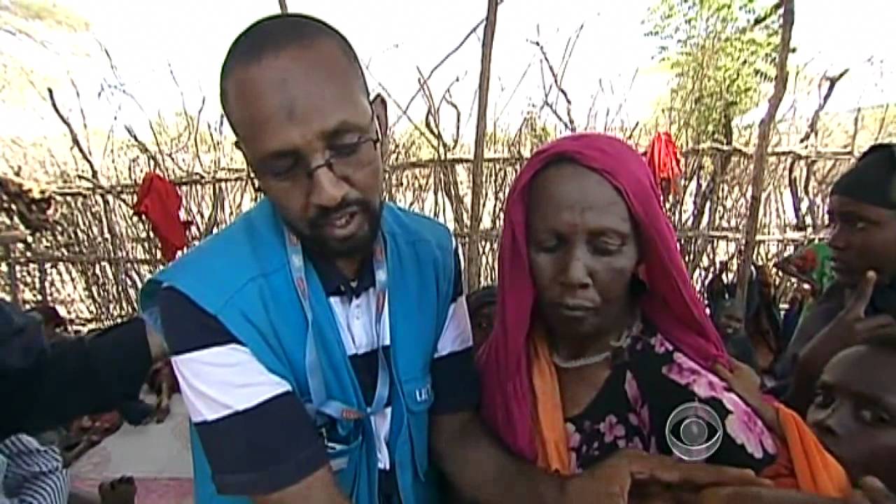 Starving Somali child recovers