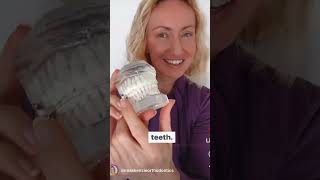 Recommended light force braces.