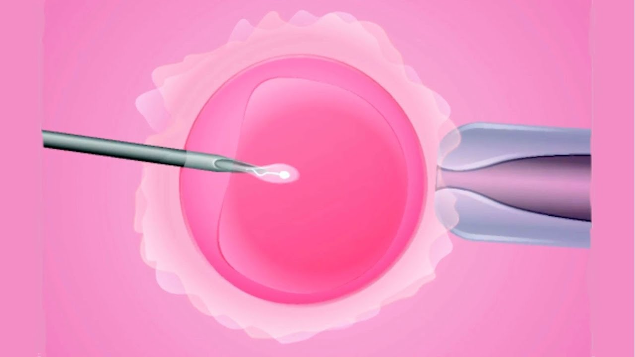 הפריה חוץ-גופית: מה שצריך לדעת