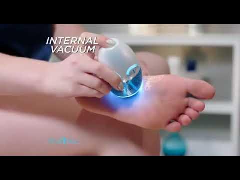 Pedi Vac by Ped Egg - Callus Remover for Feet with Built-in Vacuum Removes  Dead Skin from Feet with 2000 RPMs - Electric Callus Remover Sucks Up