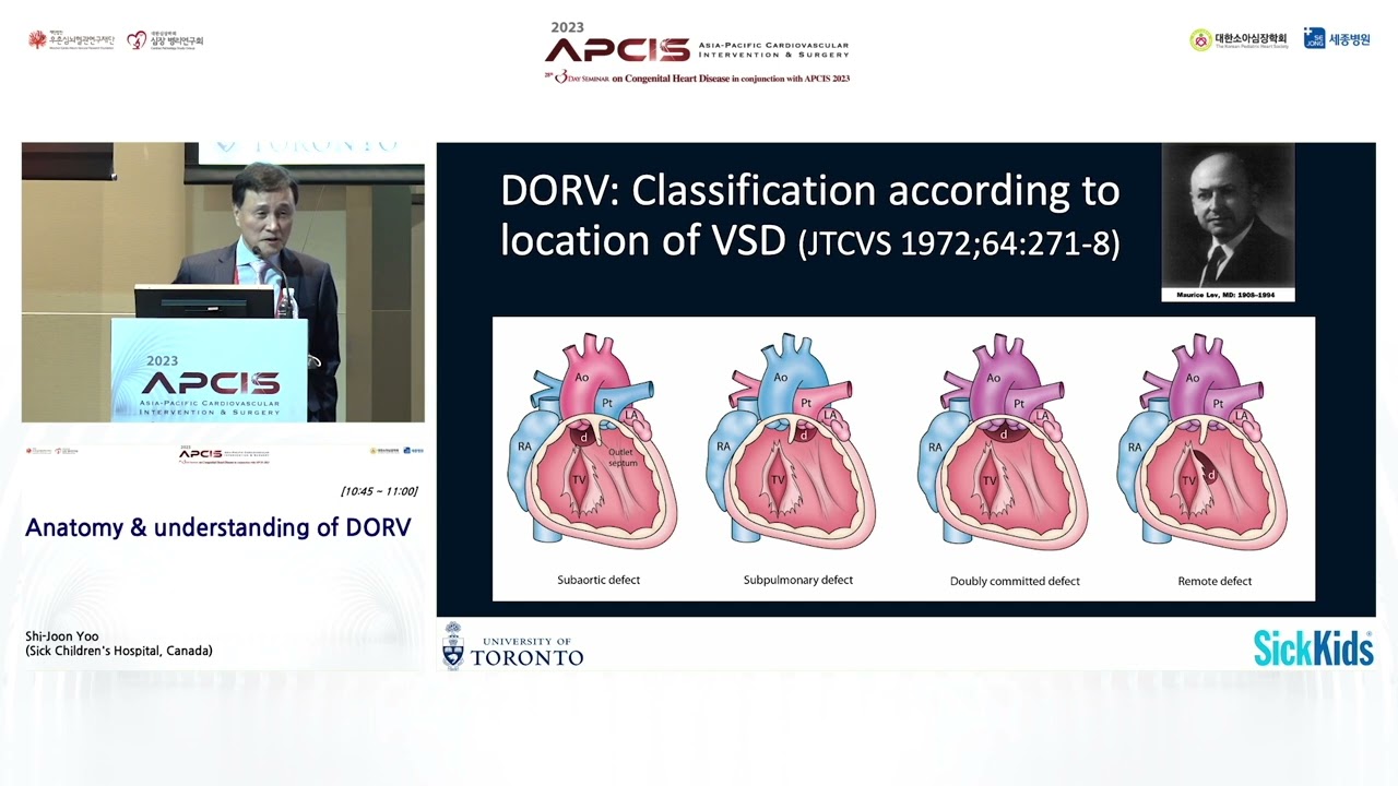 Anatomy & understanding of DORV
