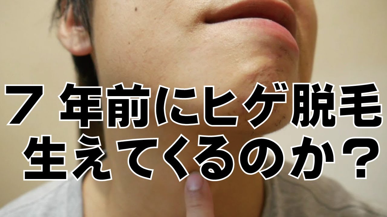 7年前にヒゲ脱毛をしたおれが2ヶ月間ほったらかしにしたらヒゲはまた生えてくるのか Youtube