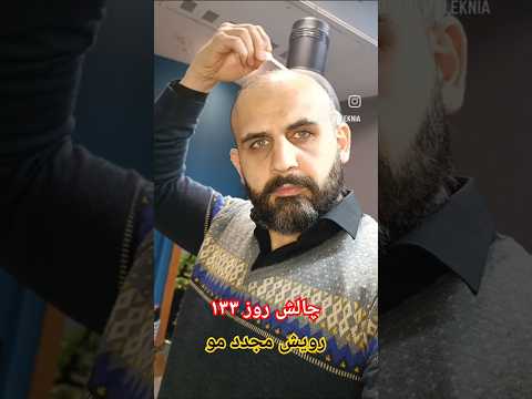 چالش روز ۱۳۳ رویش مو مو 