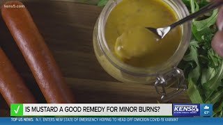 VERIFY: Is mustard a good remedy for minor burns?