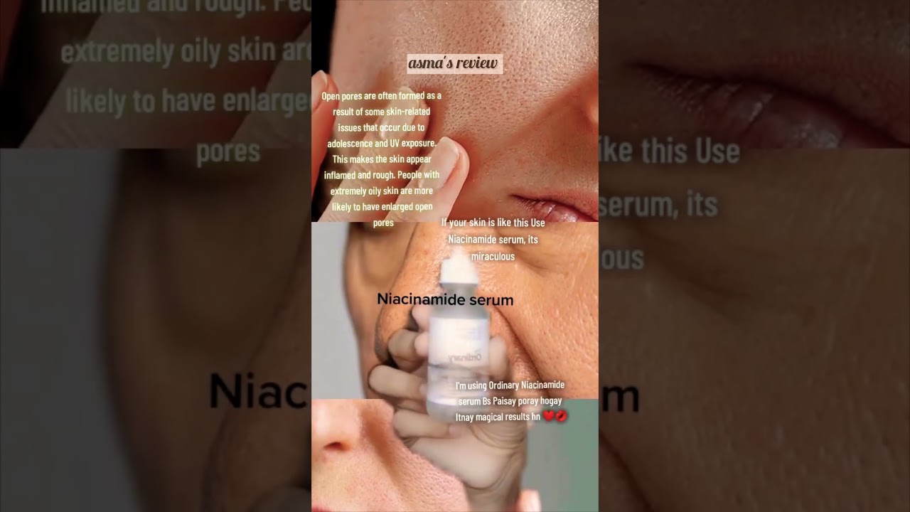 "Revitalize Your Skin with Ordinary Niacinamide Serum! | The Ultimate Skincare Hack" 
