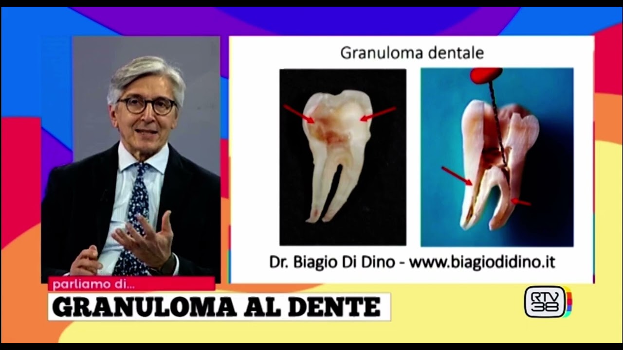 Il granuloma si può curare. Guarda come