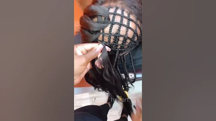 This Amazing Alopecia Transformation Shows How Anyone Can Have Beautiful Hair Again!