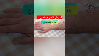 أعراض نقص الفيتامين د ستنصدم من وجودها