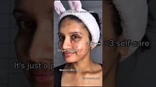 Clear Skin Transformation Acne Glow