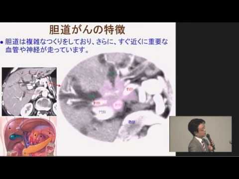 胆管がん・胆のうがんの診断・治療と今後について　森実 千種