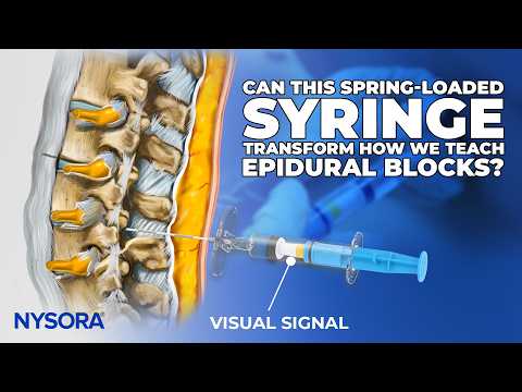 Thumbnail for Epidural: From Loss of Resistance to Visual Confirmation