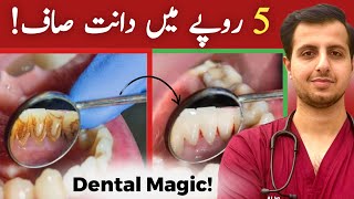 Ghar Par Daant Safed Karne Ka Tarika The No Teeth Whitening Method With 2 Ingredients