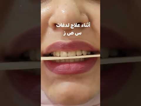 علاج لدغه س ص ز لسن 20سنه