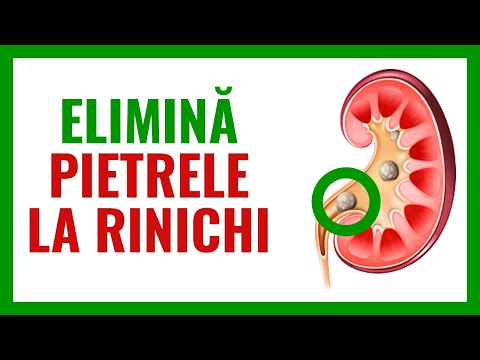 8 CEAIURI PENTRU PIETRE LA RINICHI 🌿💐🌳 Ceai pentru rinichi  - ceai pentru nisip la rinichi