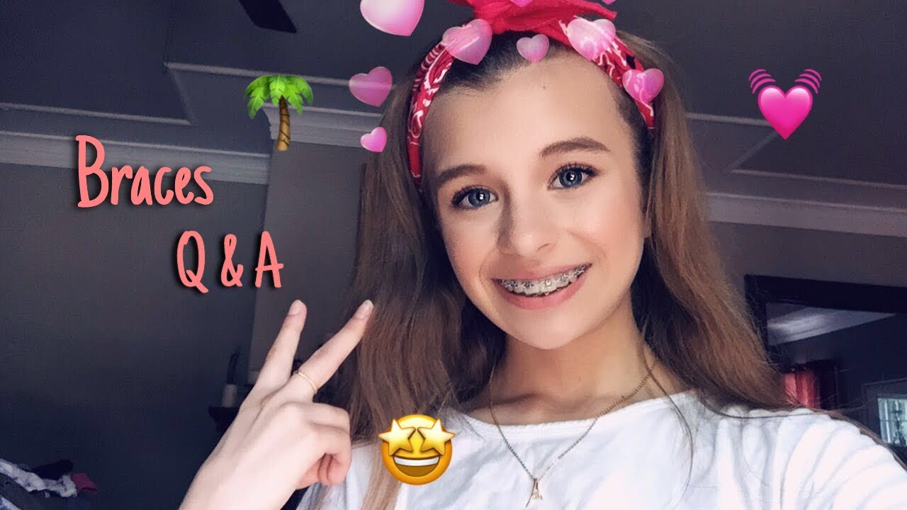 Braces q & a YouTube