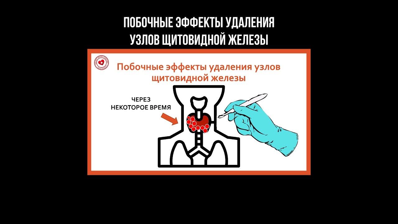 Как избавиться от узлов