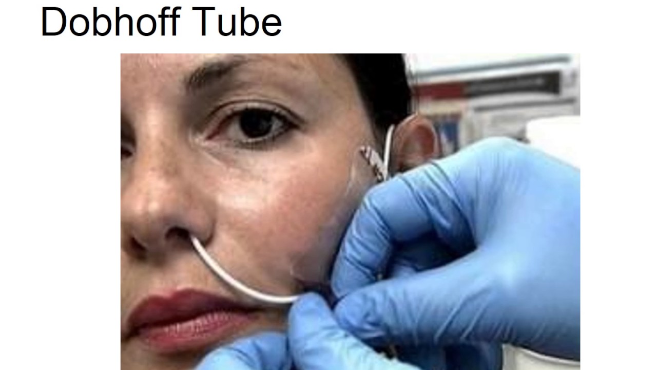 Assisted Feeding Chapter27 2016 YouTube