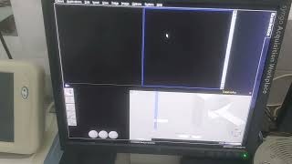 Check error CTscanner :Siemens Med Service software. screenshot 4