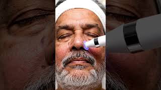 “Robot Vacuum Facial 😱 | Oddly Satisfying Pore Extraction ASMR”