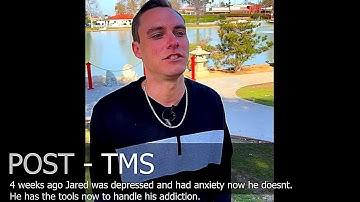 TMS Before and After