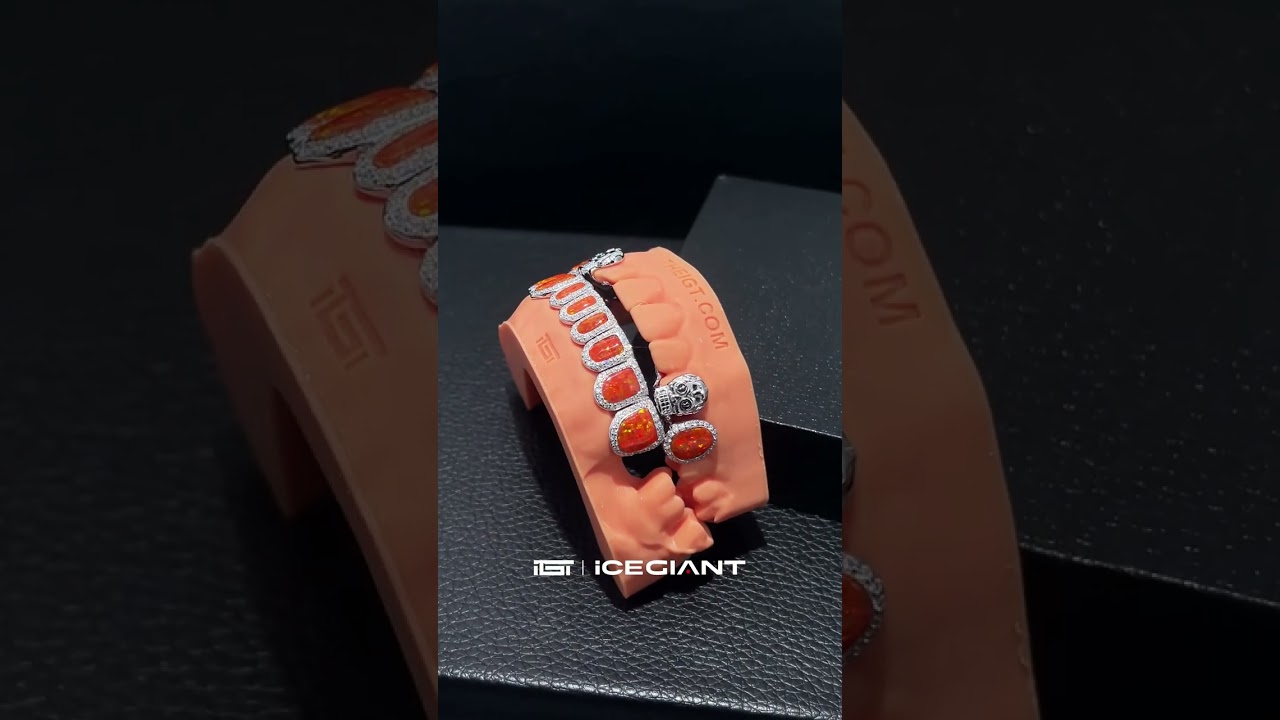 Custom skull 💀 grillz