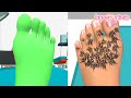 Kaki Bebas Bulu | Foot Clinic | Game Happy Alicia