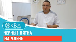 Черные пятна на члене. Клинический случай №66