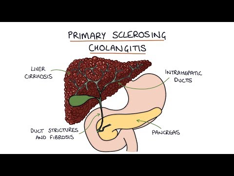 וִידֵאוֹ: Primary Sclerosing Cholangitis (PSC)