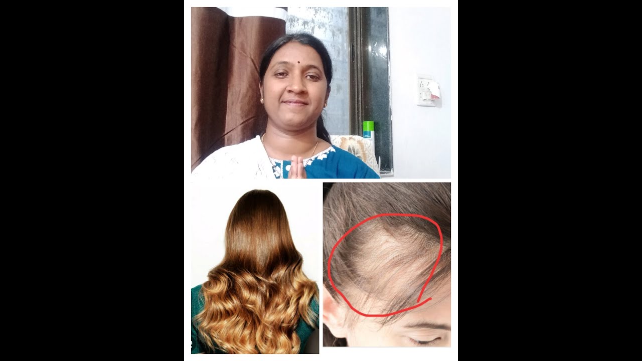 Hair fall solutions by Dr Prajakta Ravi Bhad Ayurveda for healthy