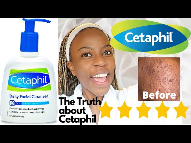 Cetaphil Skin Care Cleanser Review 2022