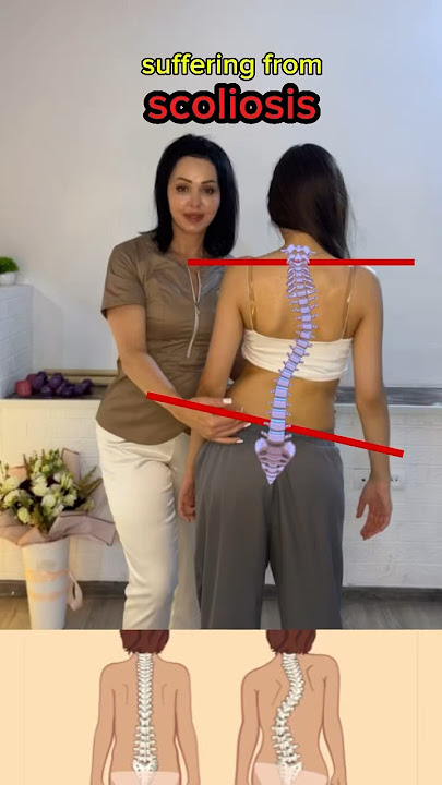 Essential exercise for managing scoliosis. strengthen your core and improve spinal health #scoliosis