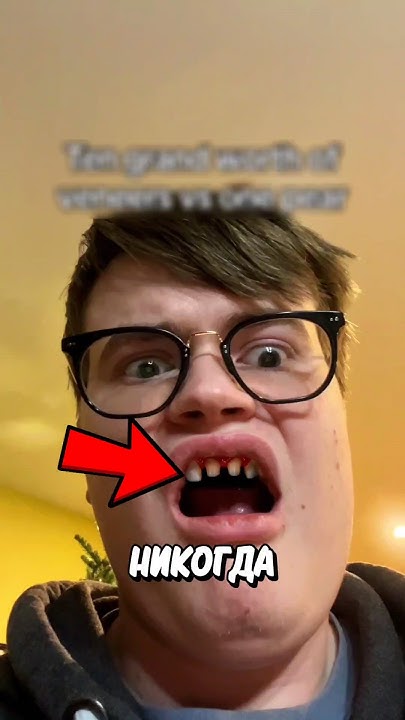 Опасные Острые Зубы! 😱 - YouTube